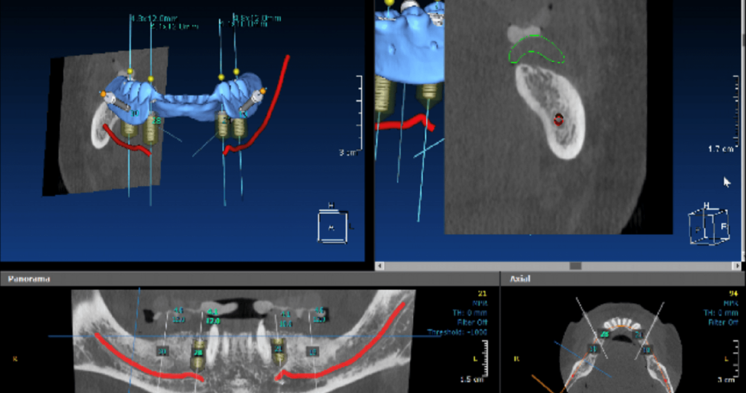 GuidedSurgery01-min